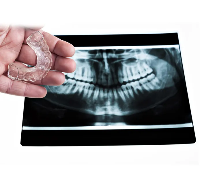 Dental Radiographs X Rays